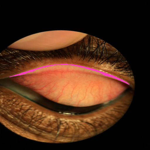 LG-Staining-Eyeball Sclera-segmented